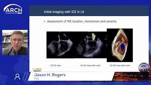 Intracardiac Echo for Structural Heart Disease: When and How to Use it?