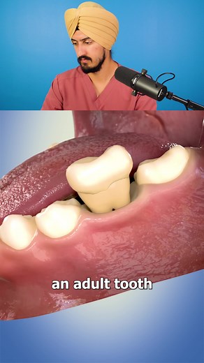 How to Replace a Missing Tooth with Dental Implants