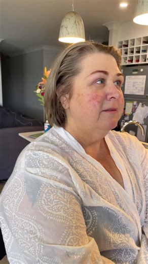 From nervous..to radiant✨ She came in unsure, and left glowing-laughing, crying, and FULL of confidence. Her skin concerns didn’t hold her back, and it was the most beautiful reaction to witness. With her rosacea flare ups & initially being nervous about sharing a before until I explained that THIS is what REAL brides want to see. That I can help you! Brides, this is why I love what I do-every transformation is about confidence, calm, empowerment, and you feeling radiant in your own skin. 🩶 I h