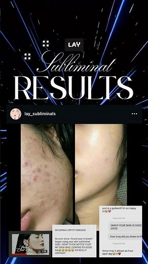 Clear Skin Transformation Using Subliminals #subliminal