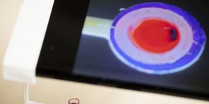 Blood Test Only Needs a Drop and a Smartphone for Results