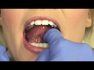 Oral Cancer Screening