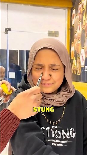 How Apitherapy Is Practiced😳 #shorts