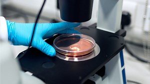 Google desarrolla un microscopio que funciona con IA para detectar el cáncer