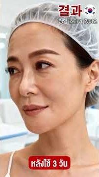 หมอโซจู@สารสกัดArbutin-พิเศษเพียง599