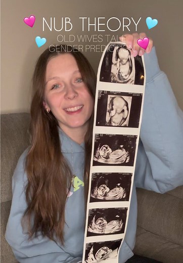 Understanding Nub Theory for Baby Gender Reveal