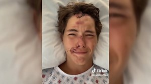 TikTok personality Caleb Coffee says he’s on the mend after his family says he fell 80 feet off a cliff onto lava rock in Hawaii. | Inside Edition