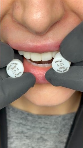 More behind the scenes in my lab helping a patient select the color of her new teeth