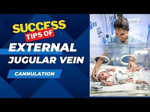 External jugular vein cannulation success tips.