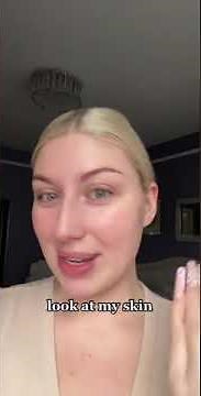 Musely Review: Rosacea Skin Care To Reduce Redness!