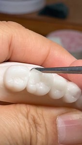 Detail teeth contour from 28 unit Diagnostic wax up! Full video available from Our Private Memberships!.. feel free to join us! Patreon.com/lukekahng YouTube.com/lsk121 | CEO Luke Kahng