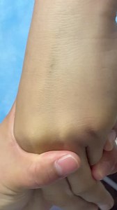 454K views · 1.2K reactions | #NurseLife #NursingCare #reels...