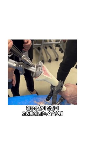 무릎 관리를 열심히 해야 하는 이유