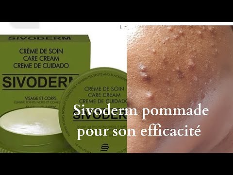 Why I used Sivoderm ointment on my face. My review