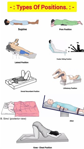 Types Of Positions l All types of positions l#medical #ytshortsviral #shortsviral #education #study
