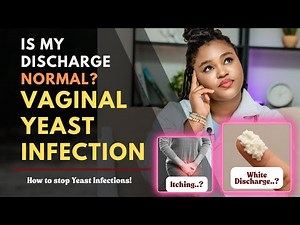 Symptoms of Vaginal Yeast Infection | How to prevent and get rid of it | Vaginal Thrush.