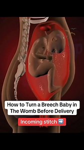 955K views · 4.3K reactions | Simple Home Exercises That May Help Turn Breech Baby Head Down Before Labor #laboranddelivery #HealthyBaby #breechbaby #healthypregnancy #midwifechiamaka | Midwife Chiamaka | Facebook