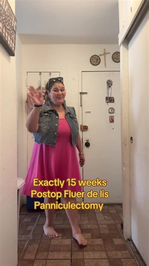 Panniculectomy 15 Weeks Postop Update: Healing, Weight Changes, Swimming Advice