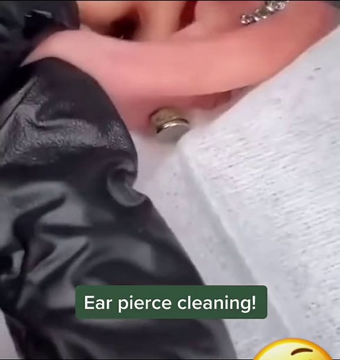 Junk removal from ear. #pimplepop #extractions #cystpopping #oddlysatisfying #blackheadsremoval #cystexplosion #cystexplosion #earcleaning #earcleaningvideos