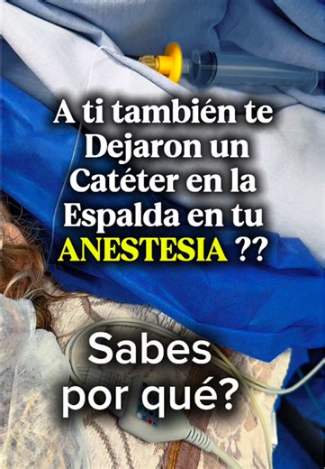 💉 Catéter epidural: ¿para qué sirve? Es un tubito muy delgado que colocamos en la espalda para administrar medicamentos directamente cerca de los nervios. 👉 ¿Qué logramos con esto? • Quitar o disminuir el dolor • Mantenerte cómodo durante y después de cirugía • Evitar exceso de medicamentos por vena • Ideal para cirugías largas, porque permite administrar más anestésico en caso necesario sin necesidad de volver a funcionar 👶 Es muy usado en parto (analgesia epidural) 🏥 También en cirugías y 