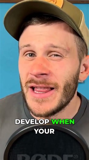 The "Keto Rash": A Surprising Fasting Side Effect!