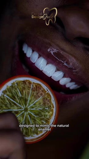 ✨ Witness the magic of your first smile moment! At Dental Design Smile, every transformation is crafted with precision, harmony, and artistry — because your smile deserves nothing less. 💎 From your first consultation to your final reveal, our team ensures a luxury experience with free VIP transportation and hotel stay in Miami. 🌴 📩 DM us “MIAMI” to begin your smile transformation today. #DentalDesignSmile #MiamiSmile #SmileTransformation #PorcelainVeneers #SmileDesign #CosmeticDentistry #Smil