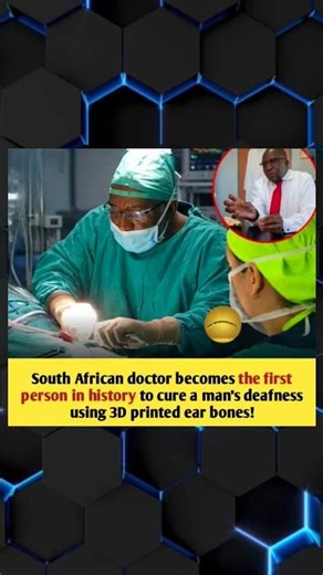 South African doctor becomes the first person in history to cure a man's deafness using 3D printed