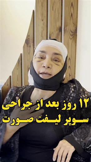 ‎سوپر لیفت صورت | کلینیک دنیز‎ | ‎بعد از چند وقت نتیجه نهایی سوپر لیفت صورت معلوم میشه⁉️ (برای دیدن رد بخیه‌ها و اطلاع از هزینه کافیه عدد ۱ رو کامنت کنین❤️) در پاسخ به این...‎ | Instagram