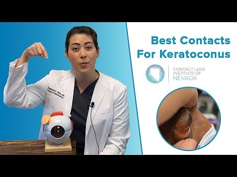 Best Contact Lenses For Keratoconus