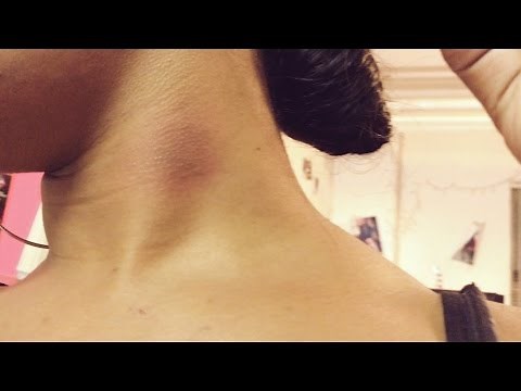 HICKEY PRANK ON BOYFRIEND!