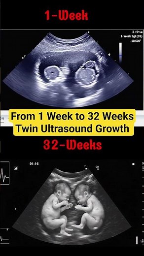 Twin Ultrasound: From 1 Week to 32 Weeks | Baby Development Journey
