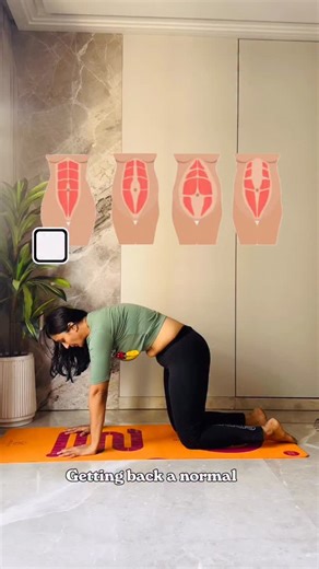 Varsha Shah|Yoga Practitioner| on Instagram: "When the linea alba becomes stretched, your core loses tension. That’s why you see: — doming — coning — lower belly hanging — back pain — weakness while lifting or even breathing. If you have doming, an open gap above/below the navel, lower belly hanging, or weakness — this is your reminder that your body is NOT broken. It just needs the right guidance, the right breath, and the right sequence. I’ve opened enrollment for my Core Healing Programme ✨ ✔