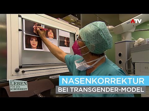 Nasenkorrektur bei Transgender-Model Sabrina Anderson | Nasen-Operation durch Dr. Jörg Knabl