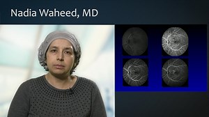 CNVM Detected on OCTA - Eyetube