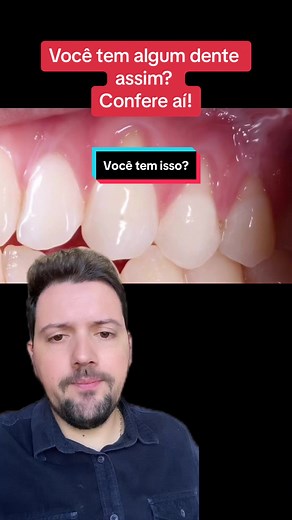 Como Lidar com a Sensibilidade Dentária devido à Retração Gengival