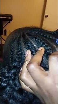 THE BIGGEST DANDRUFF FLAKE EVER