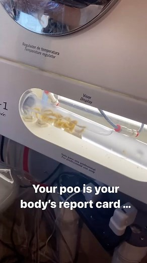 Because your poo is a daily report card—giving us insight into your gut, hormones, liver, stress, and more. Here’s what I’m looking for when a client tells me about their bowel habits 👇 💩 Constipation – This isn’t just “sluggish digestion” – It often means poor bile flow, low stomach acid, magnesium deficiency, or even hormonal shifts (especially low thyroid or low progesterone) – And if you’re not eliminating daily, your body is reabsorbing toxins and estrogen 💩 Loose, urgent stools – This c