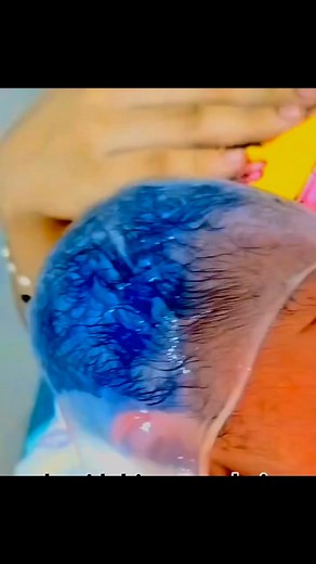 How baby just born | The birth room