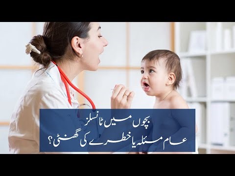 Tonsillitis In Kids | When Surgery Is Needed? | Tips by Dr. Sadaf Haroon