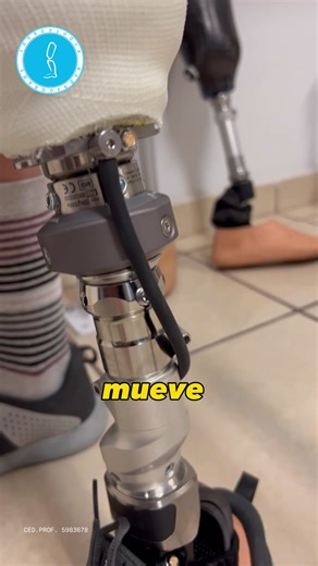 Sistema de Sujeción de Prótesis: Vacío Pasivo vs. Activo