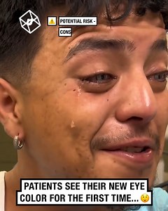 They just surgically changed their eye color… FOREVER 😳👁️ | UNILAD