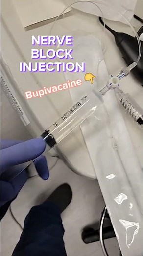 How to prepare leg surgery Nerve Block