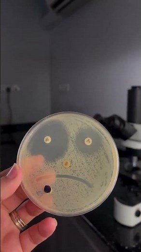 Antibiotic Susceptibility Testing E. coli Gram negative bacteria Microbiology laboratory #ESBL #CRE