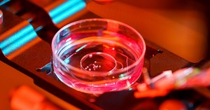Organoid intelligence: A new frontier in biocomputers or sci-fi hype?