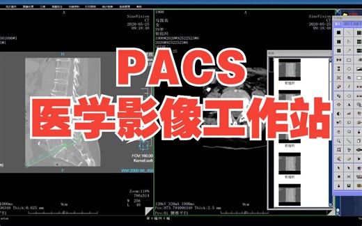 VC  6.0开发的PACS医学影像工作站 DICOM标准化开发