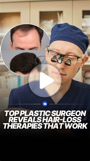 Top New York facial plastic surgeon Dr. Gary Linkov has treated thousands of men for hair loss - and says some of the most popular advice online may be sending men down the wrong path. He explains which treatments he typically turns to first, the side effects men should know about and why some popular hair-loss products may not be worth the money. Linkov also weighs in on newer options including PRP and laser caps, and explains when men should actually consider starting treatment. Read the full 