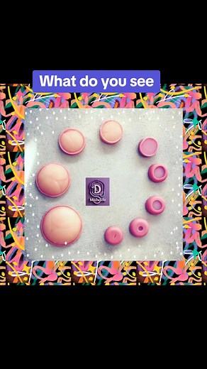 This is just an illustration of Cervical dilation which is the process by which the cervix (the lower, narrow part of the uterus) opens and widens in preparation for childbirth. During labor, the cervix gradually dilates from 0 to 10 centimeters (cm) in diameter, allowing the baby to pass through the birth canal. - 0-3 cm: Early labor, the cervix begins to soften and dilate - 4-7 cm: Active labor, the cervix dilates more rapidly - 8-10 cm: Transition, the cervix is fully dilated, and the baby is