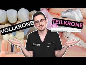 How durable are partial crowns, crowns, inlays and onlays really?