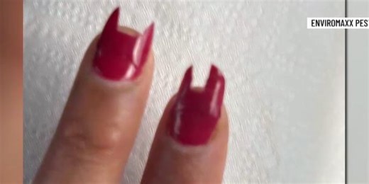 Rat chewed off part of woman’s fingernails in Las Vegas Valley, pest control GM says