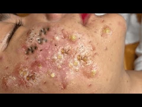 𝑫𝒆𝒆𝒑𝒍𝒚 𝑹𝒆𝒍𝒂𝒙𝒊𝒏𝒈 𝑭𝒂𝒄𝒊𝒂𝒍 𝑻𝒓𝒆𝒂𝒕𝒎𝒆𝒏𝒕 | 𝑮𝒆𝒏𝒕𝒍𝒆 𝑪𝒍𝒆𝒂𝒏𝒔𝒊𝒏𝒈, 𝑺𝒌𝒊𝒏 𝑹𝒆𝒇𝒓𝒆𝒔𝒉 & 𝑺𝒑𝒂 𝑹𝒆𝒍𝒂𝒙𝒂𝒕𝒊𝒐𝒏